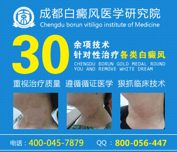 为什么白癜风久治不愈