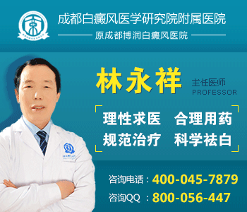 白癜风的外界因素有哪些