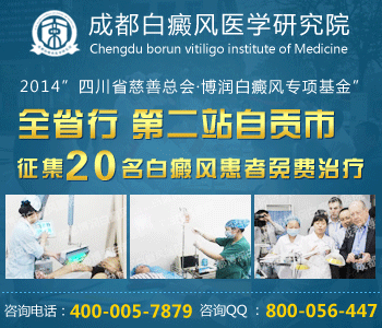 儿童为什么会得白癜风呢