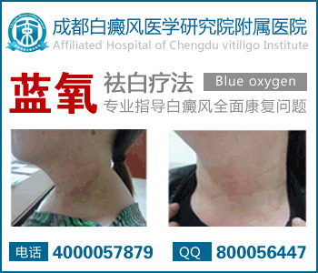 儿童诱发白癜风是什么原因