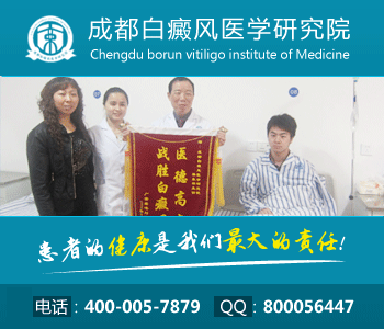 白癜风早期有什么症状