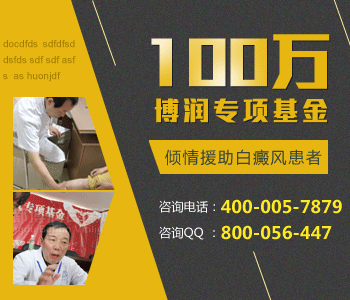 儿童白癜风怎么治疗呢