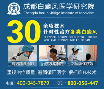 白癜风有什么症状特征