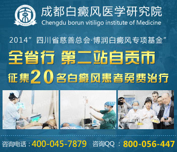 白癜风的心理治疗方法有什么