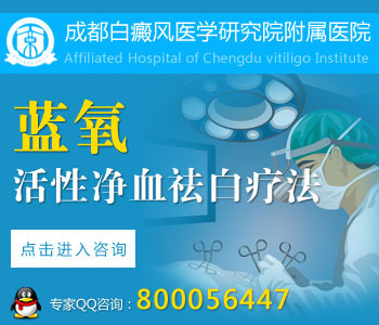 手上白癜风怎么控制