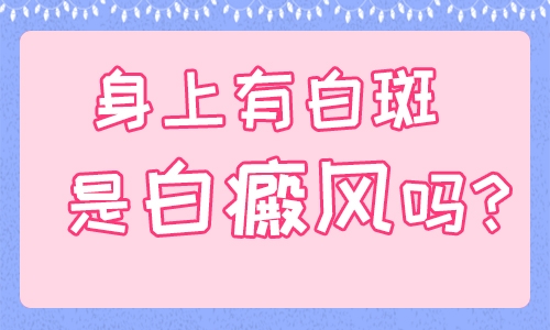 成都双楠医院是私立吗?哪些方法能诊断白癜风